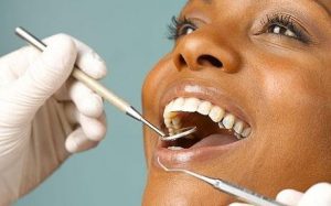 What is Gingivitis and What Causes It?