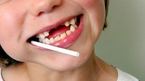 Healthier Options Help Prevent Tooth Decay