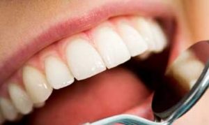 What Teeth Say About Your Health