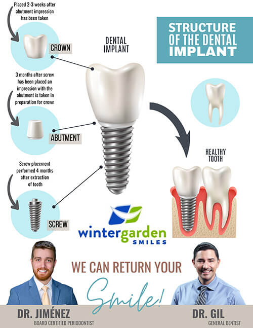 A flyer for a dental implant consultation